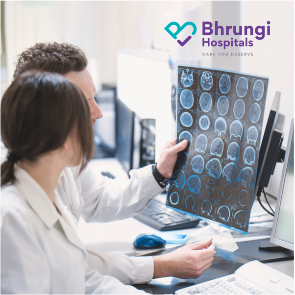 Brain and dizziness